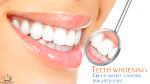 Teeth, Cleaning Tooth,, Tooth Whitening